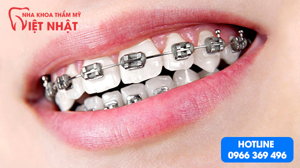 Nha Khoa Thẩm Mỹ Việt Nhật